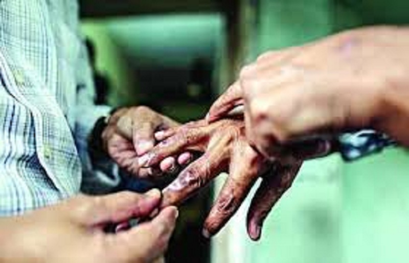 कुष्ठरोग