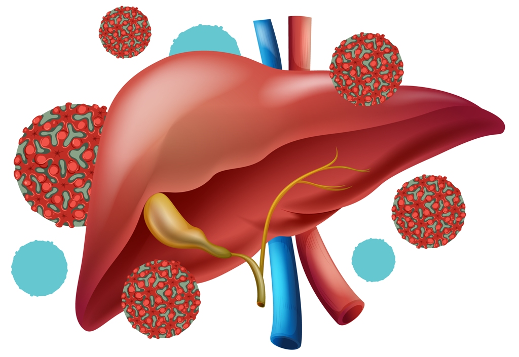 हेपाटाइटिस रोग