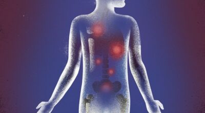 प्रोस्टेट क्यान्सर