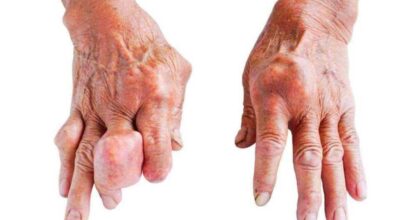 जोर्नी दुख्ने समस्या